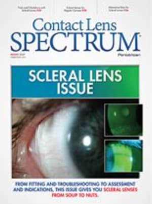 Contact Lens Spectrum