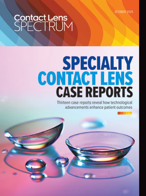 Contact Lens Spectrum