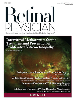 Retinal Physician