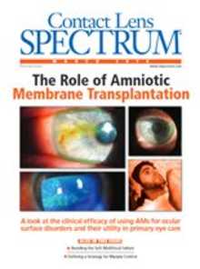 Contact Lens Spectrum