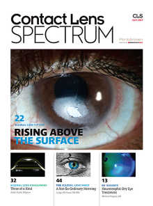 Contact Lens Spectrum