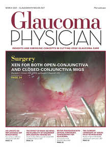 Glaucoma Physician