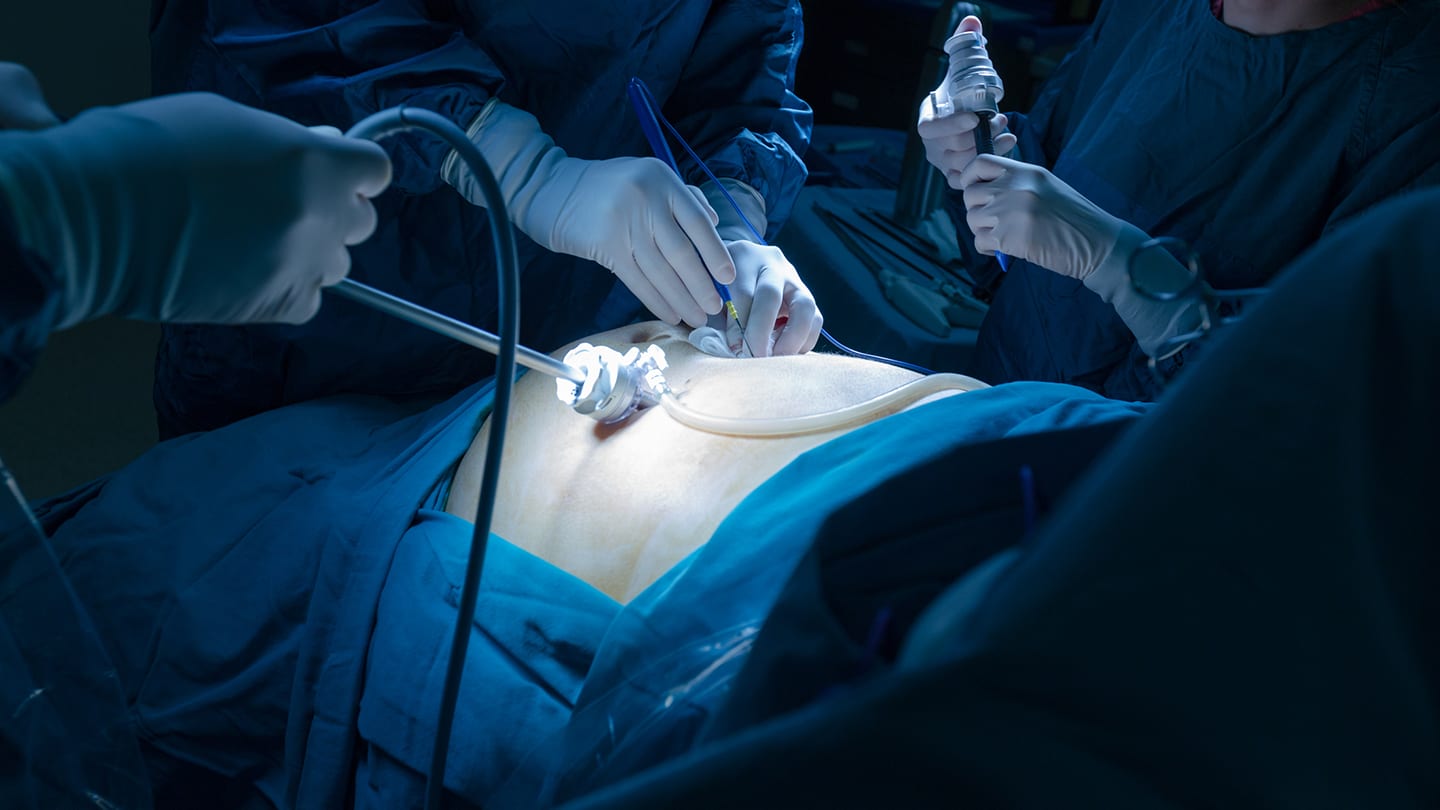Surgeon performing a minimally invasive procedure.