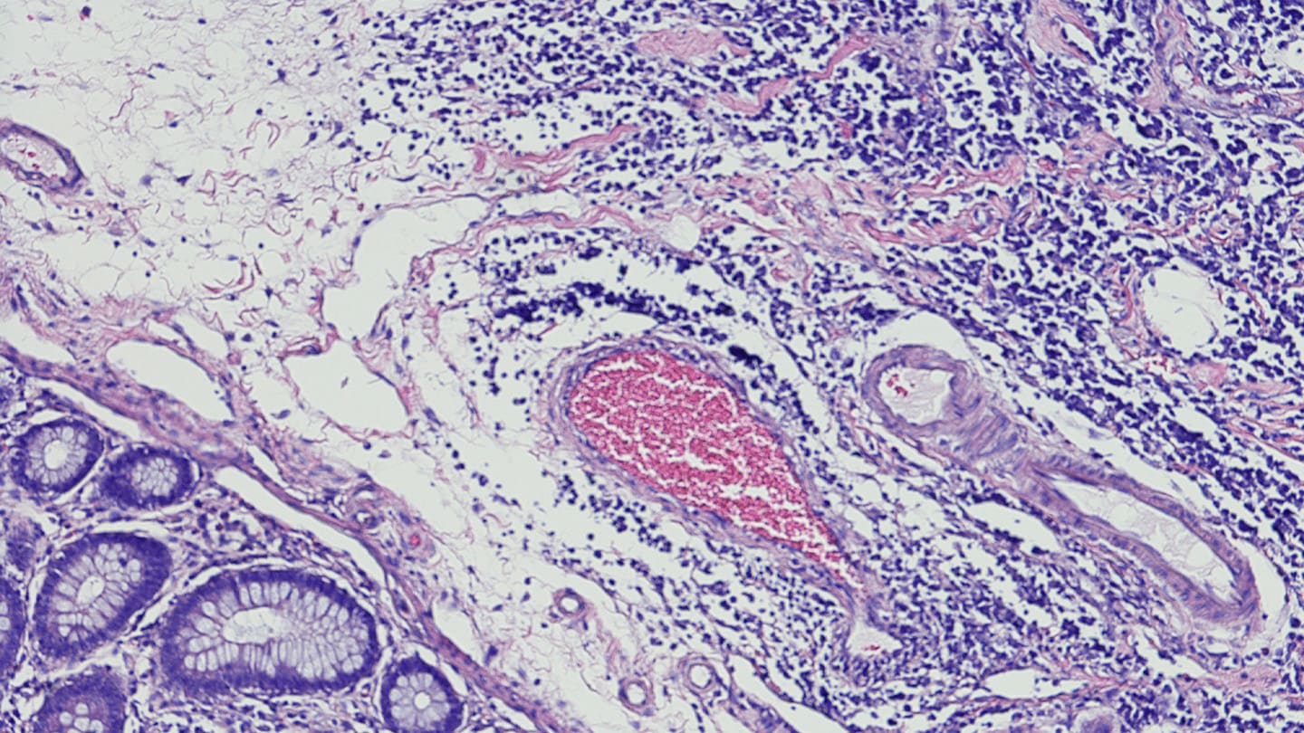 Histology image of stained lymphatic tissue.
