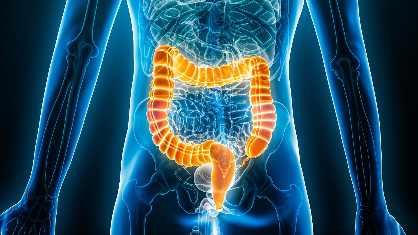 Illustration highlighting the colon in the human body.