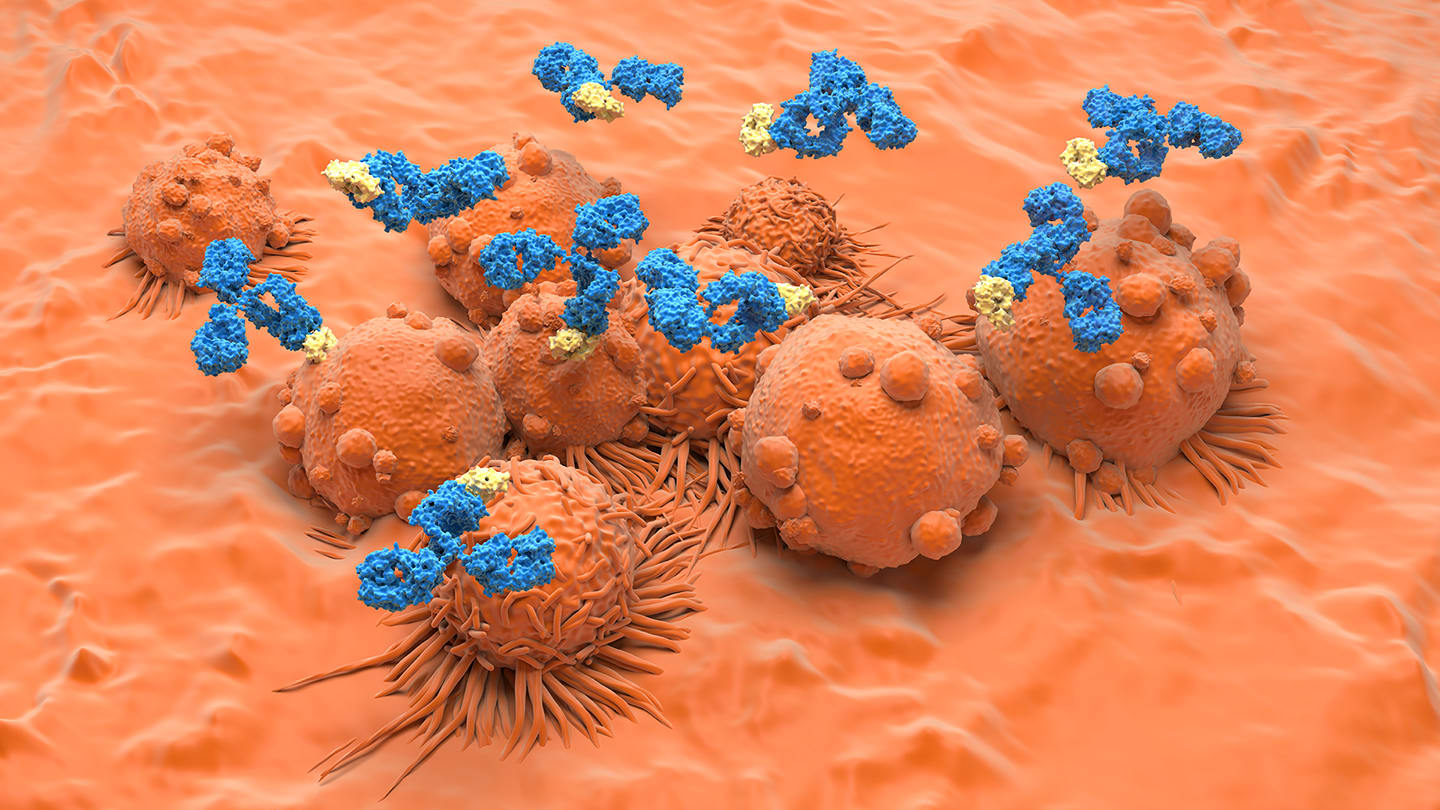 Renal Cell Carcinoma / Kidney Cancer topic