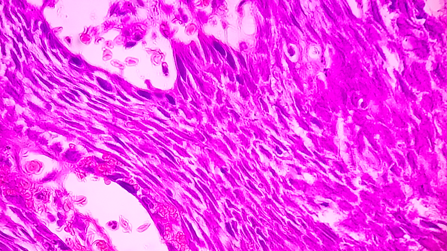 Microscopic image of stained tissue cells.