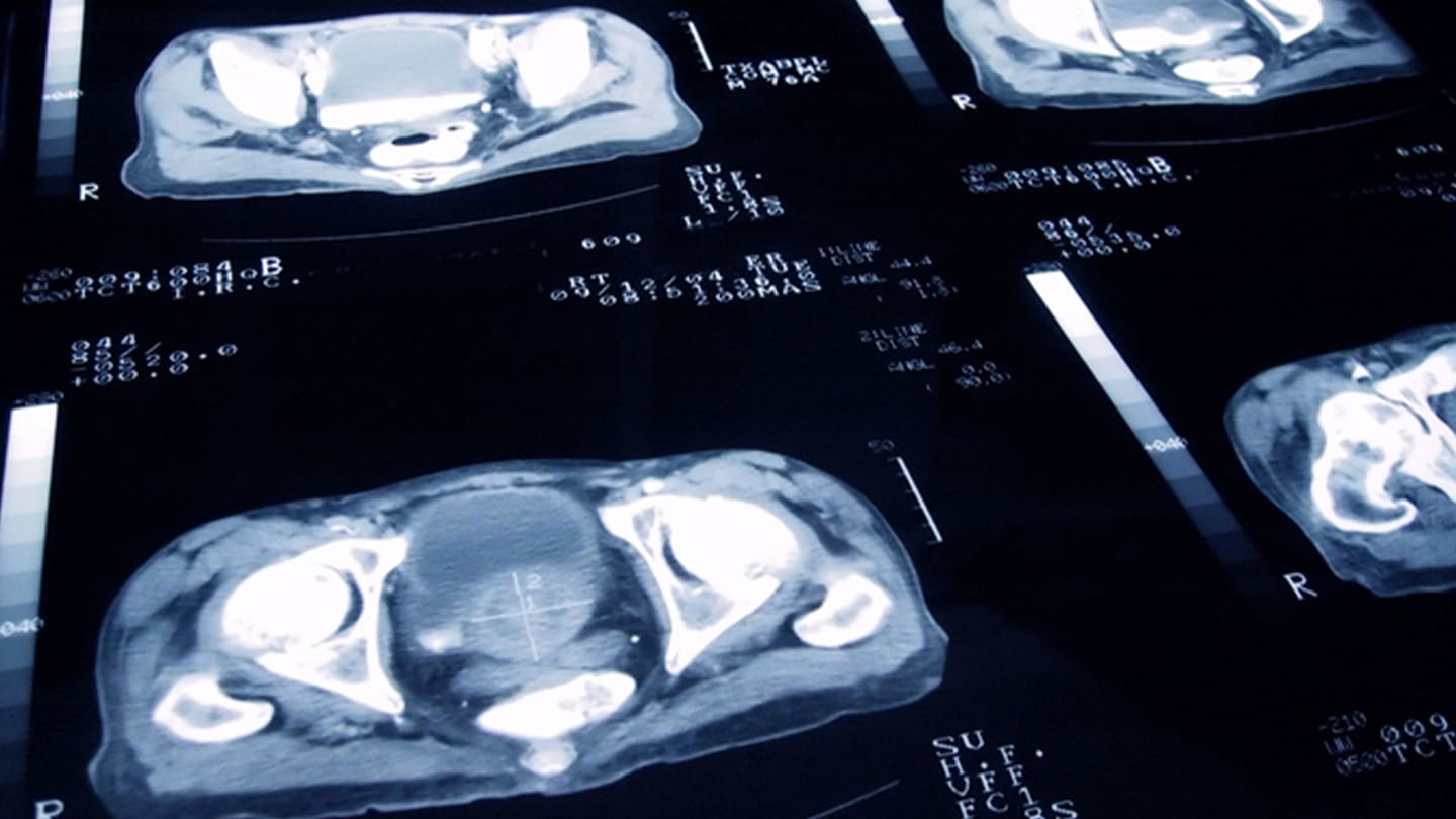 Diagnostic scan images displayed on a radiology monitor.