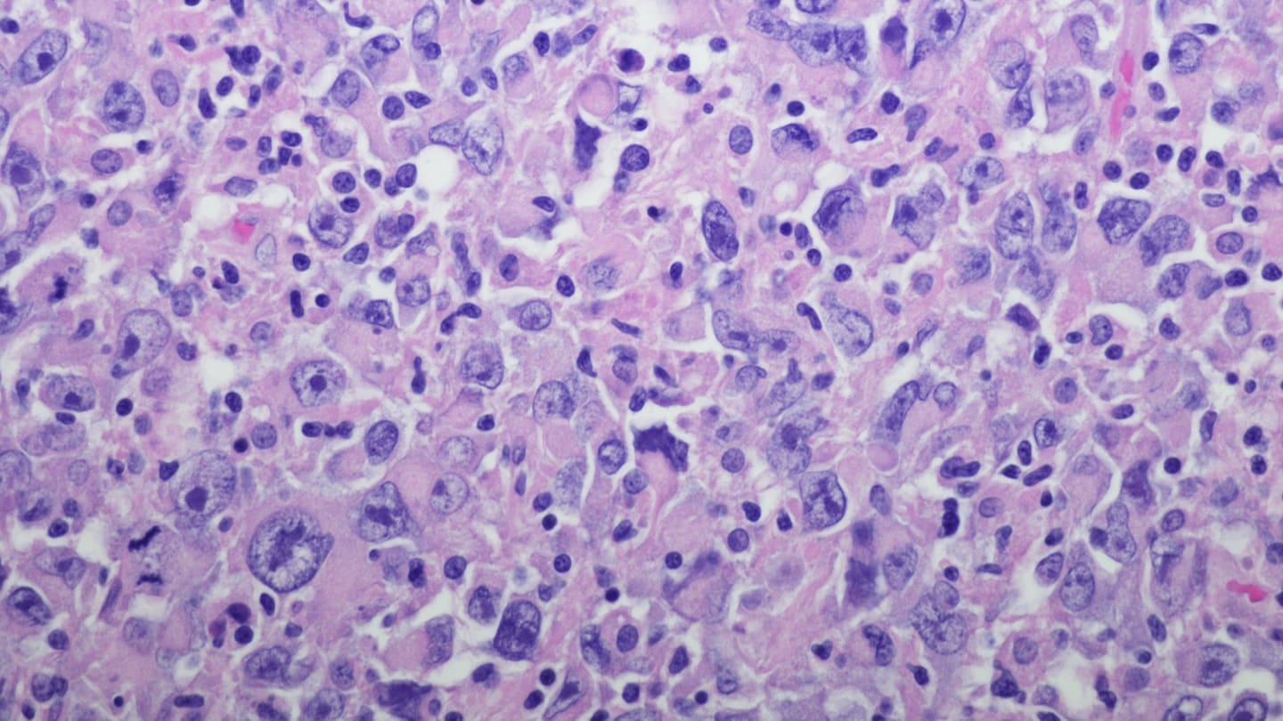 Microscopic image of stained kidney tissue.