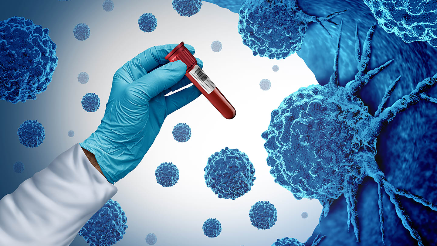 Gloved hand holding a blood sample tube.