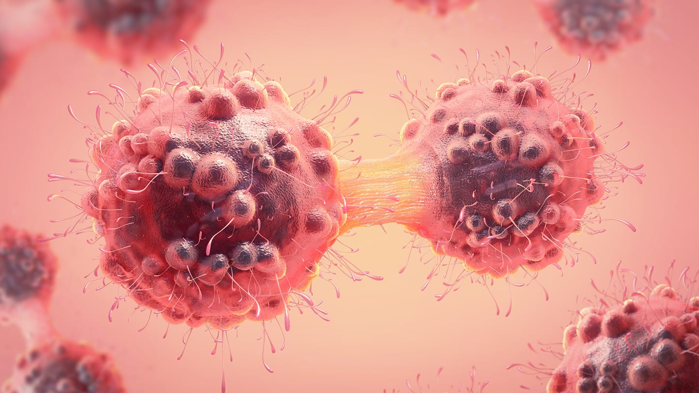 Illustration of cancer cells under magnification.