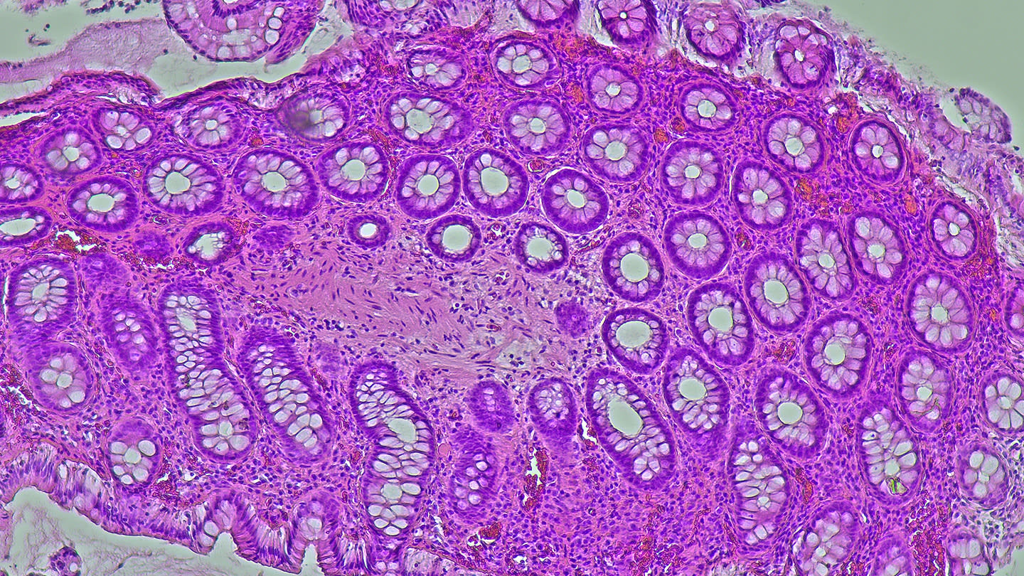 Microscopic image of purple-stained intestinal tissue.