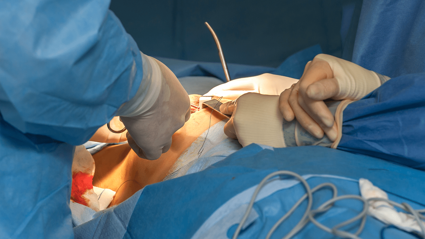 Surgeons performing an operation in an operating room.