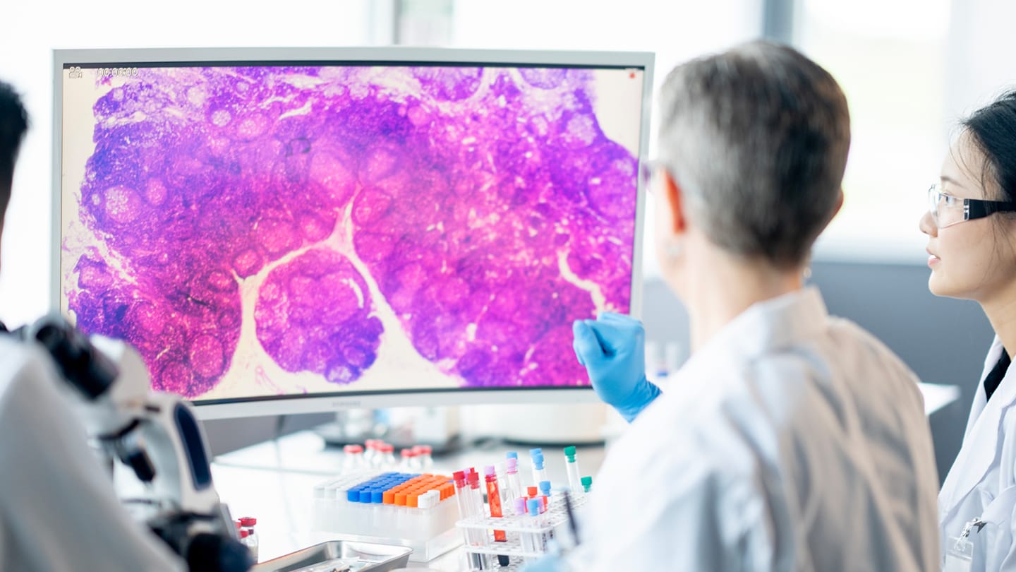 Clinicians reviewing a histopathology image on a monitor.