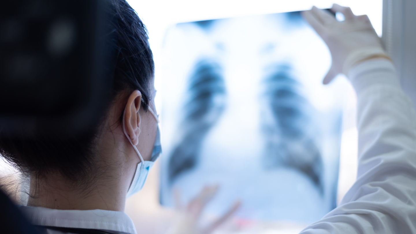 Clinician reviewing a chest X-ray.