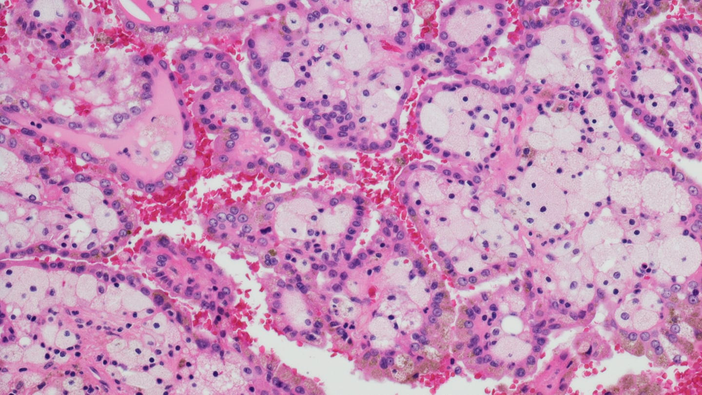 Microscopic image of kidney tissue.