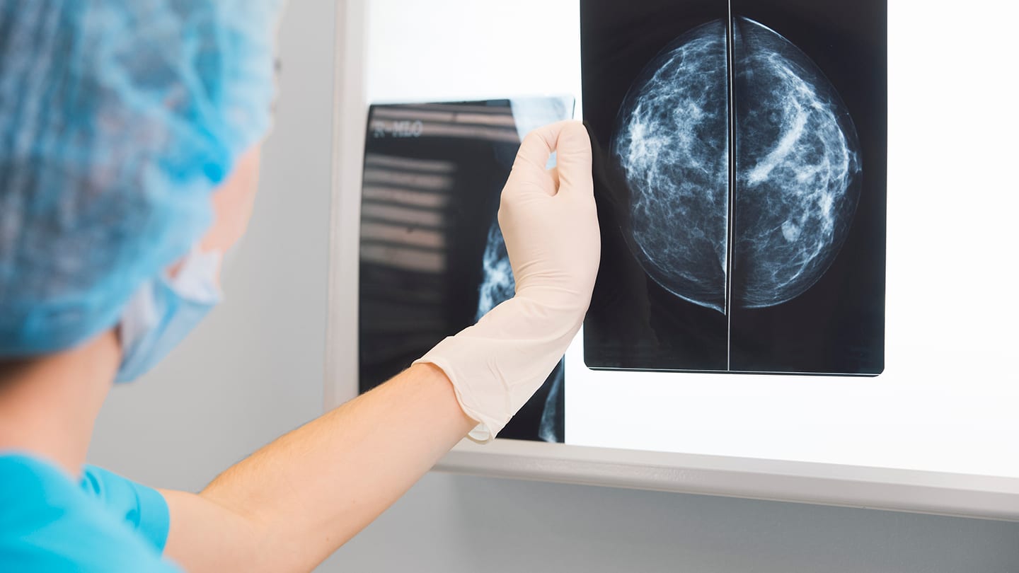 Clinician reviewing a mammogram image on a monitor.