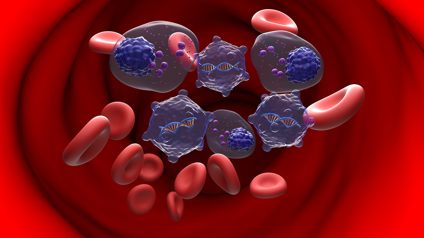 Illustration of abnormal blood cells among red blood cells.