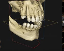 The Strategic Value of Real-Time CBCT Validation
