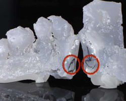Management of Impacted Maxillary Canines and Implant Placement: A Novel Classification System