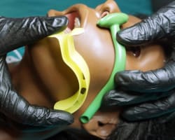 Adult OSA Outcomes With Maxillary Expansion + Thumbnail