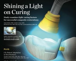 Research Update - Periodontics/Implants