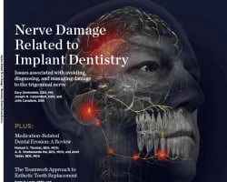 Resin Infiltration of Incipient Caries with Icon: A Patient-Friendly Approach to Caries Control
