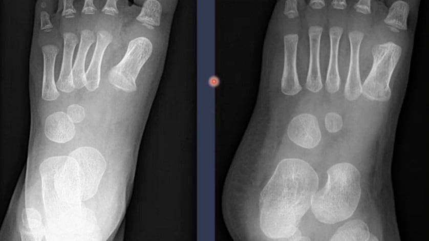 thumb description
