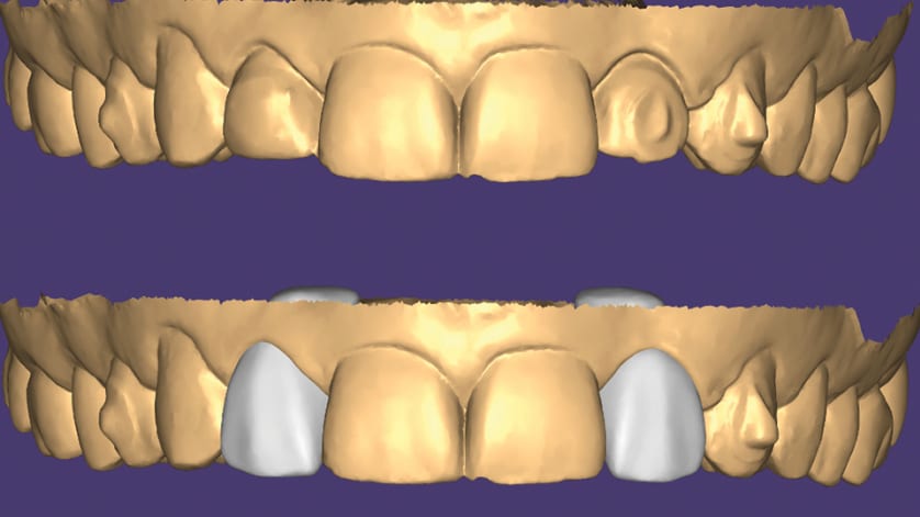 thumb description