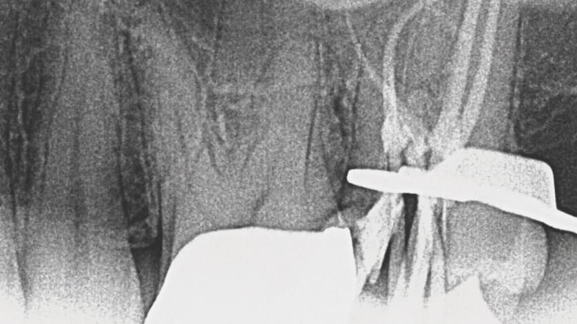 thumb description