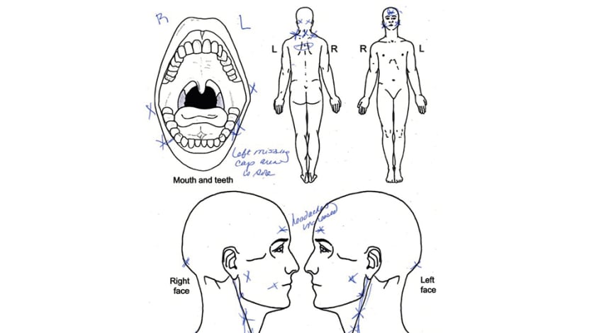 thumb description