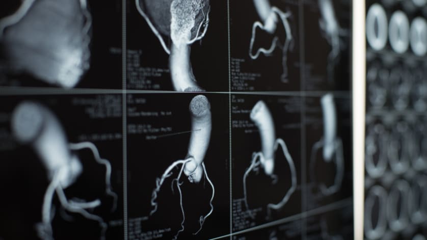thumb description