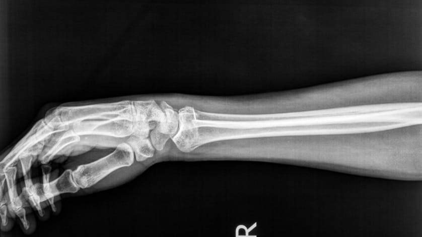 thumb description
