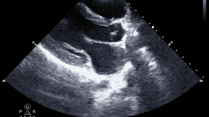 thumb description