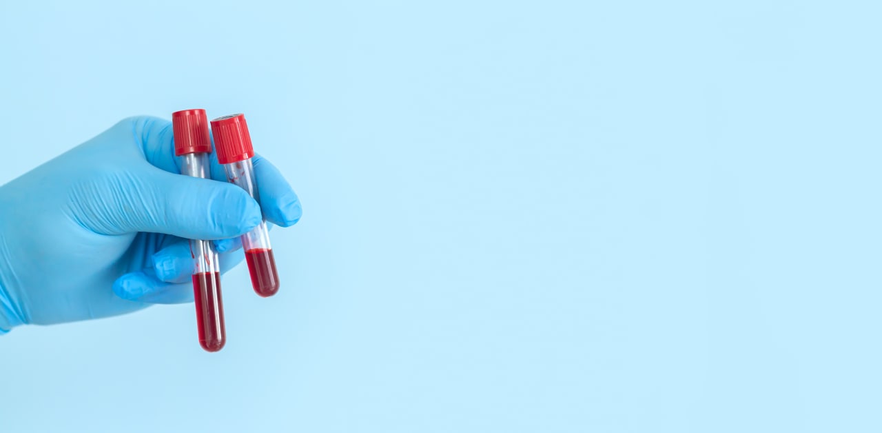 Test Tube Shortage Delaying Infection Diagnosis Conexiant