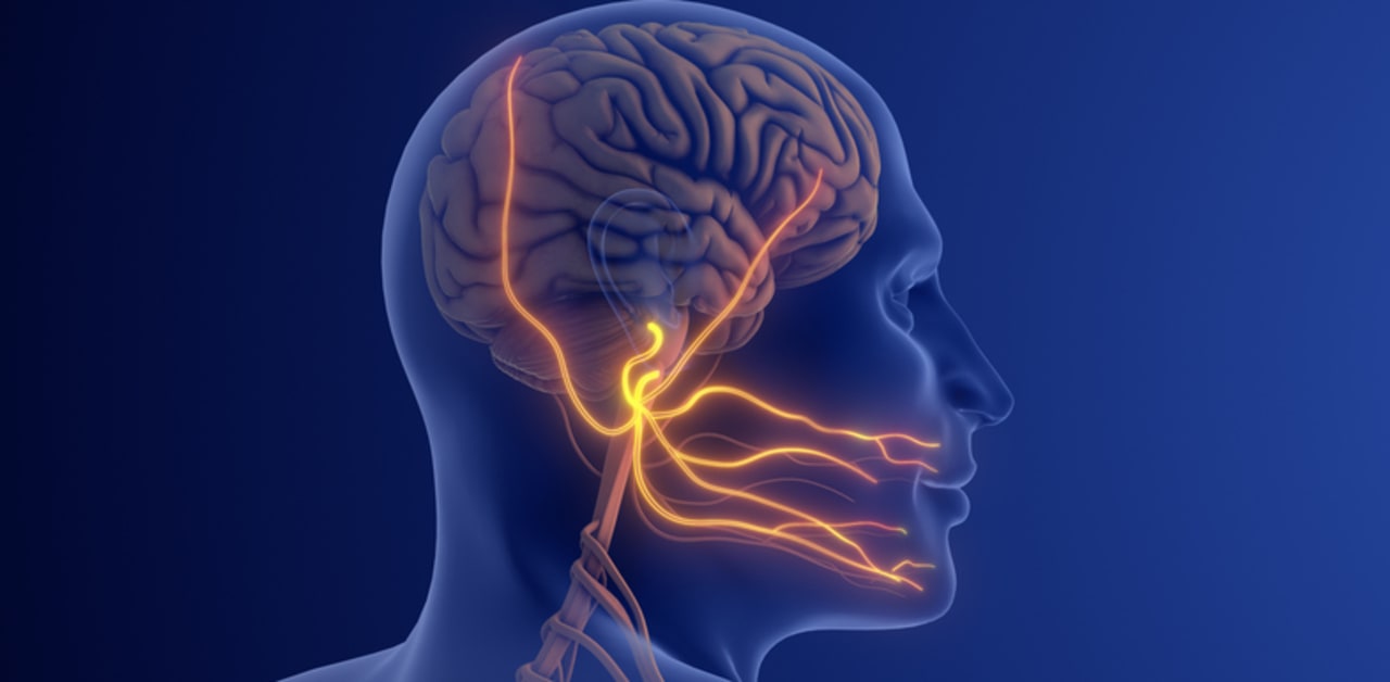 New Genetic Test Revolutionizes XDP Diagnosis, Identifies Misdiagnoses