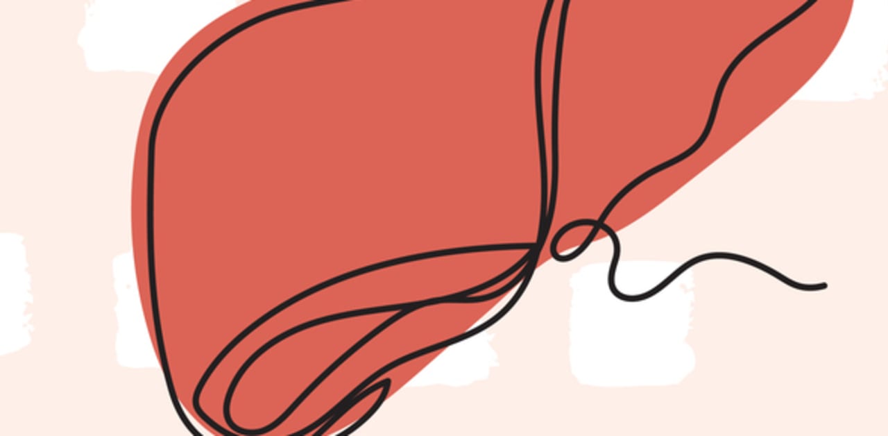 VCTE vs. histology in MASLD