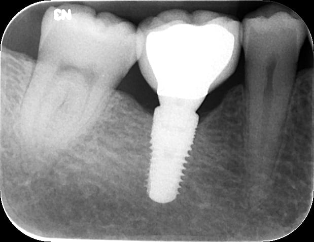 Figure 50