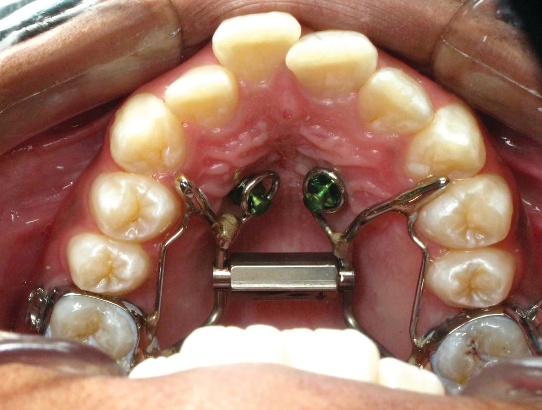 Figure 16