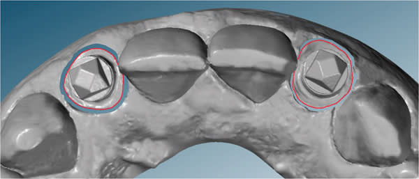 Figure 21