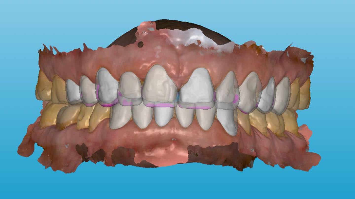 Figure 14