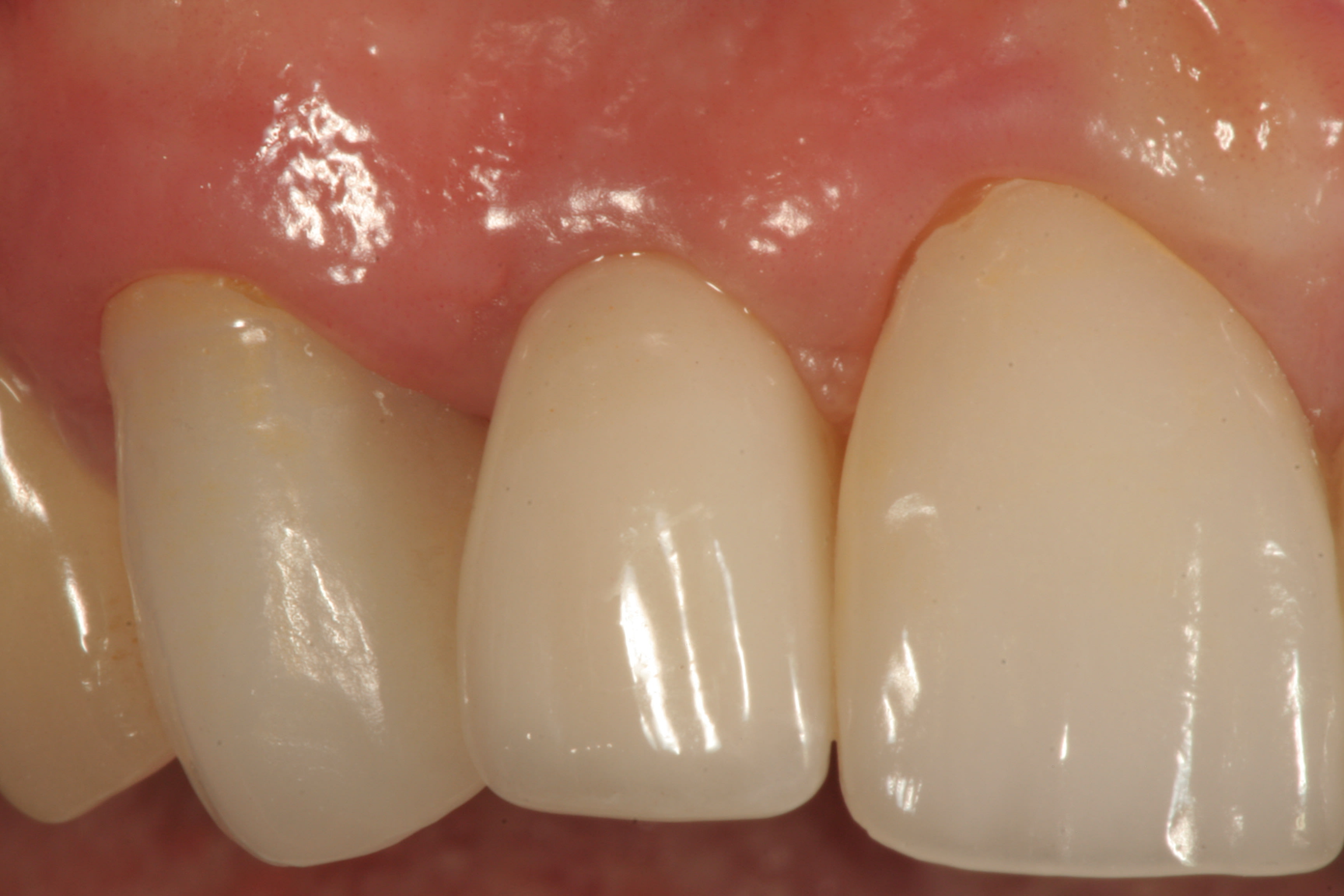 Figure 17