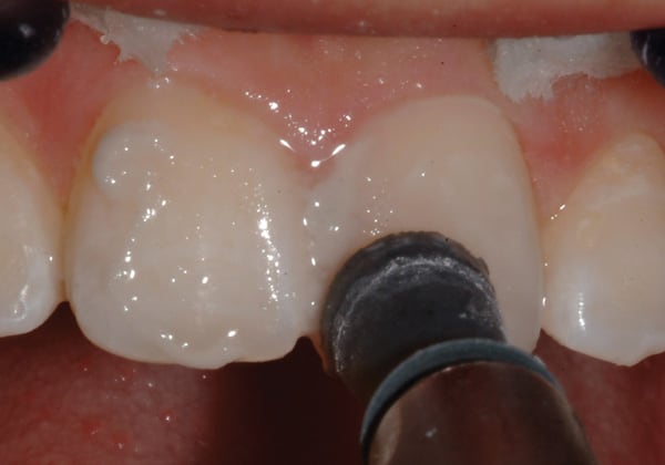 Figure 19