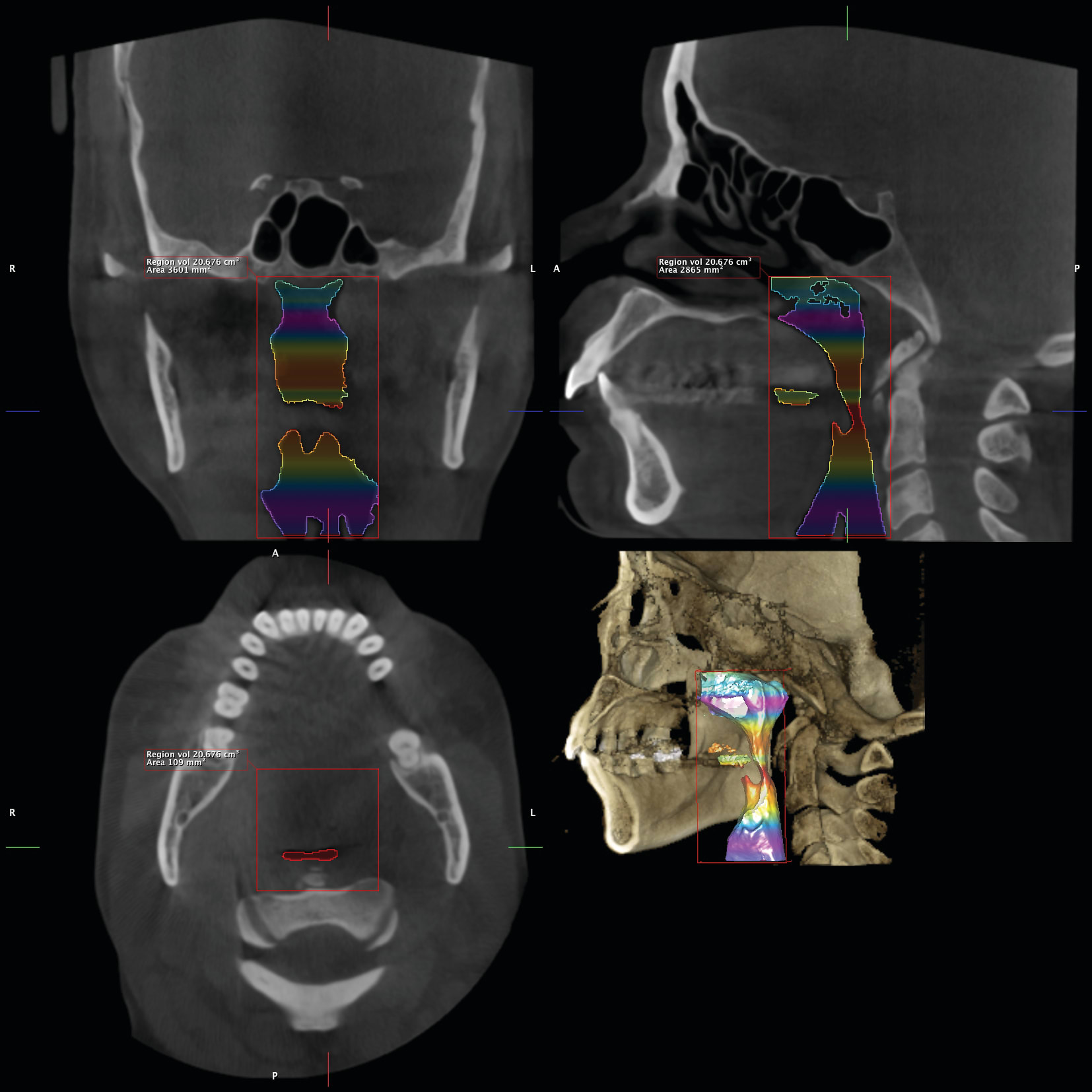 Figure 42
