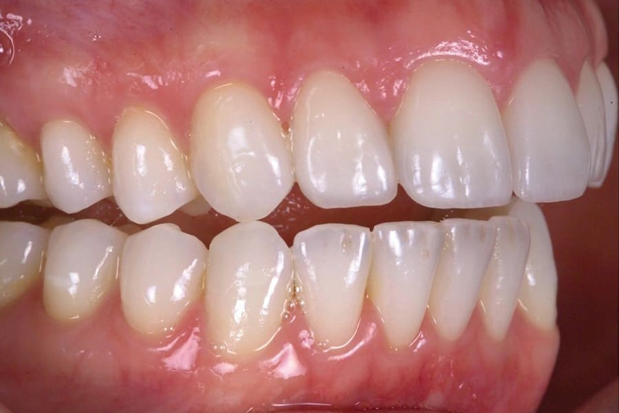 Figure 14