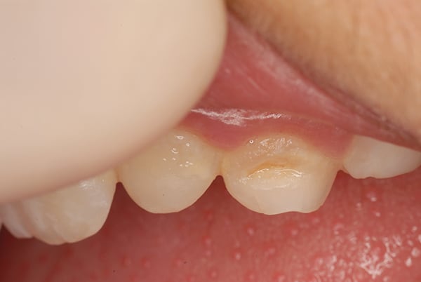 Fig.1