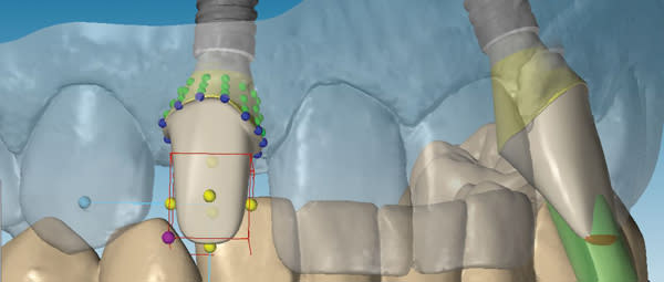 Figure 22