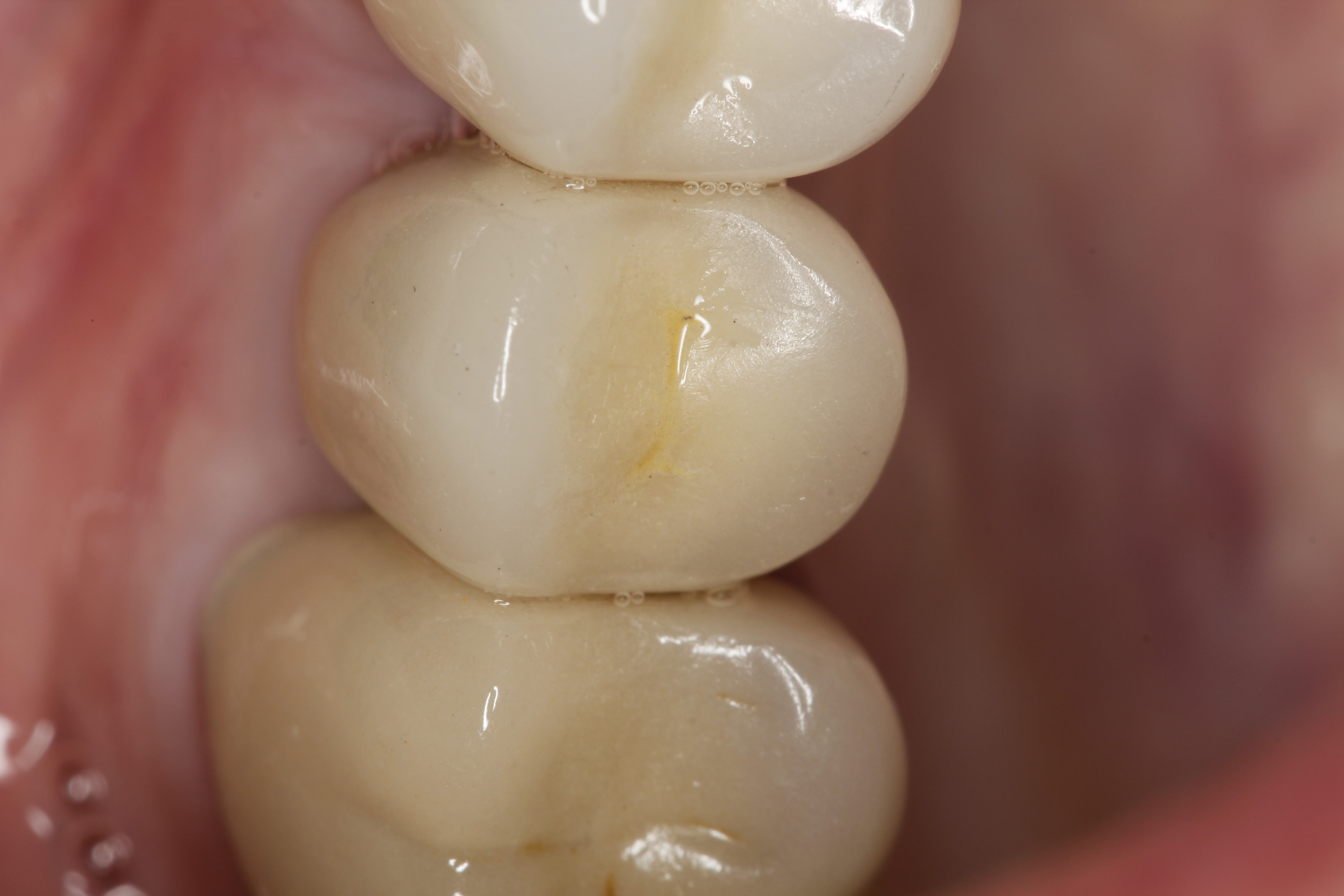 Figure 37