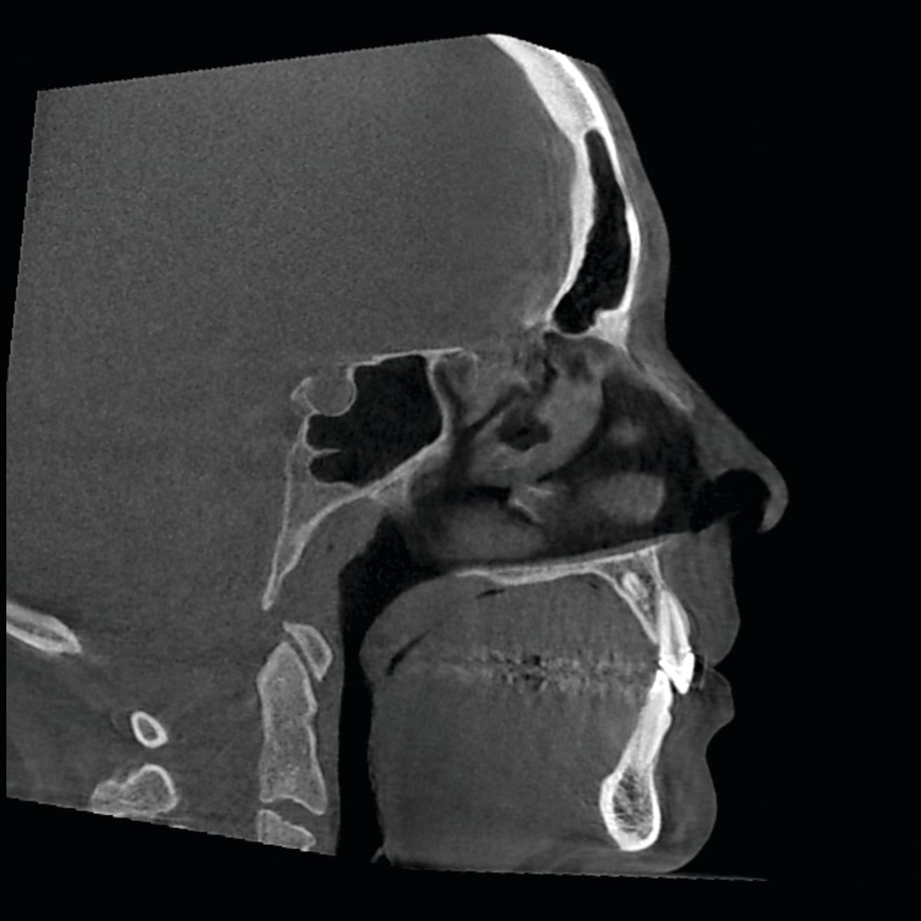 Figure 35