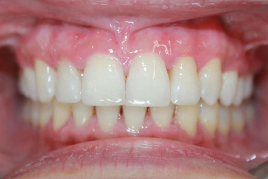 Figure 11